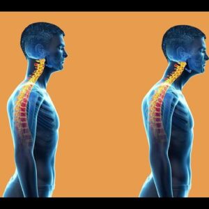 Forward Head Posture correction Powerful Plus +11x(Extra Strong)