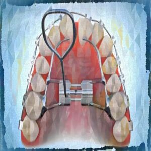Negentropic Maxilla Masterwork