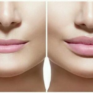 Lips Enhancement Powerful Plus +11x(Extra Strong) - Sigh Energy