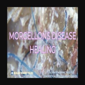 Morgellons Disease Healing +33X (Extremely Amplified Version)