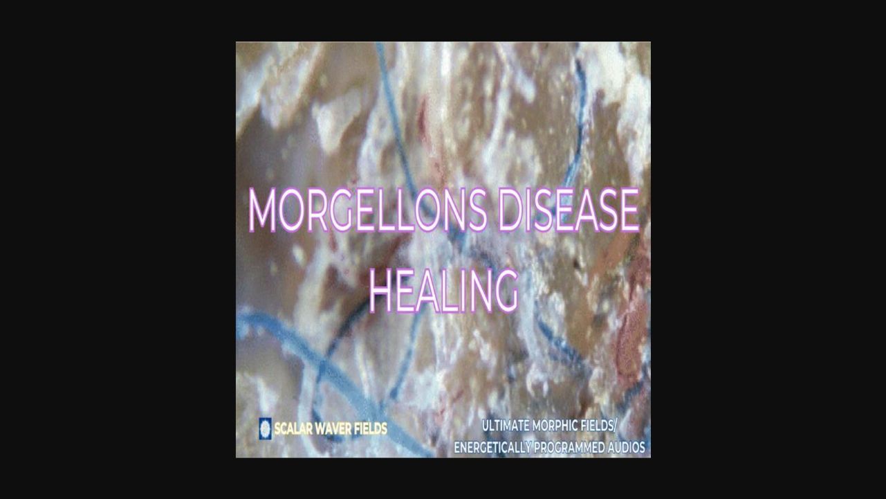 Morgellons Disease Healing +33X (Extremely Amplified Version)