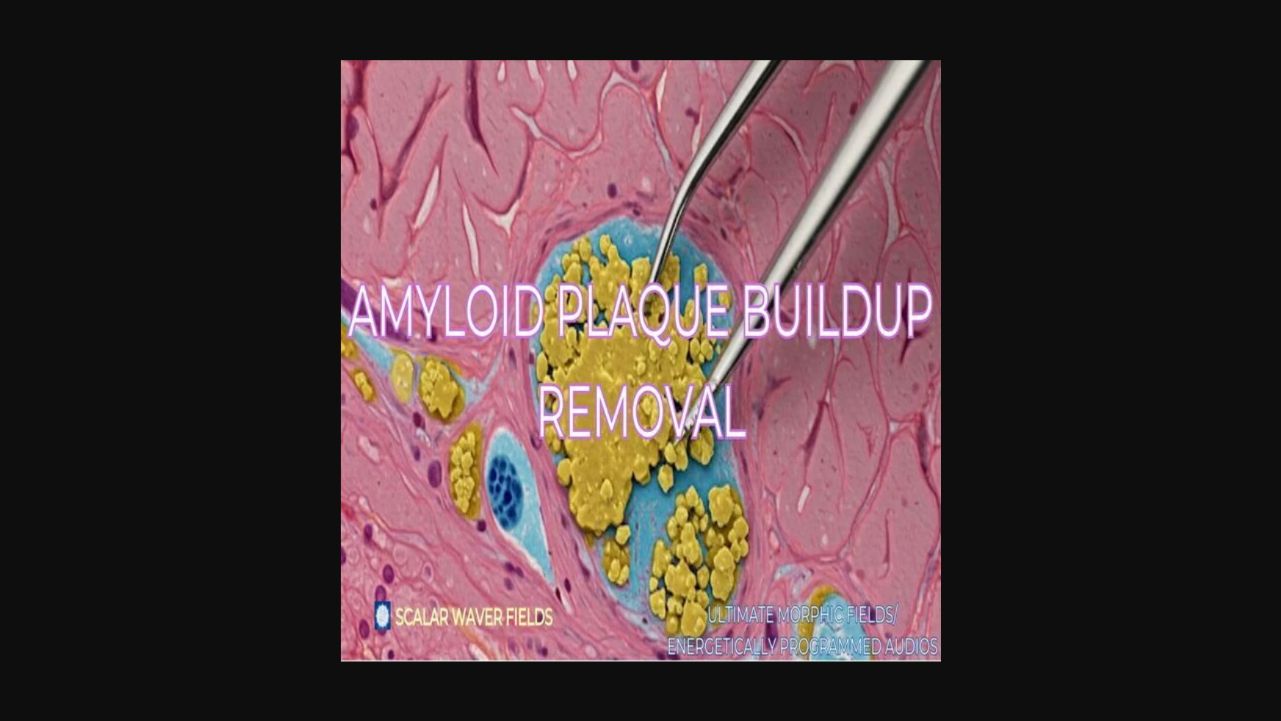 Amyloid Plaque Buildup Removal +33X (Extremely Amplified Version)